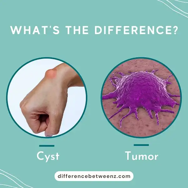 Difference between Cyst and Tumor | Cyst vs Tumor