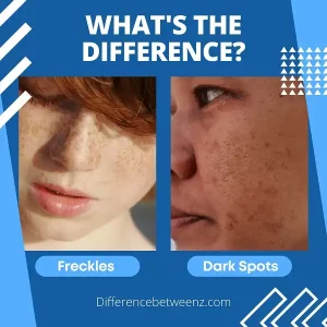 Difference between Freckles and Dark Spots | Freckles vs Dark Spots