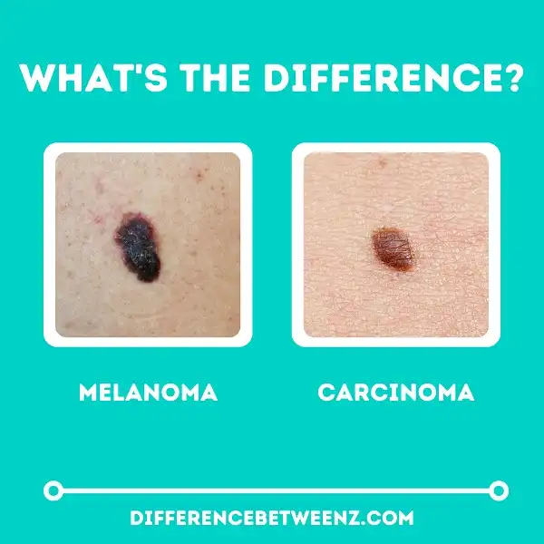 Difference between Melanoma and Carcinoma | Melanoma vs Carcinoma