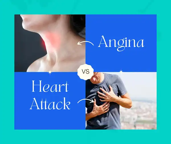 Difference between Angina and Heart Attack