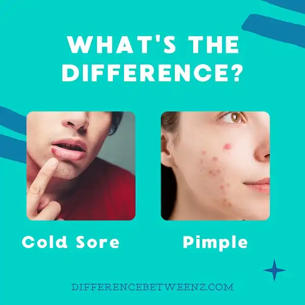 Difference between Cold Sore and Pimple