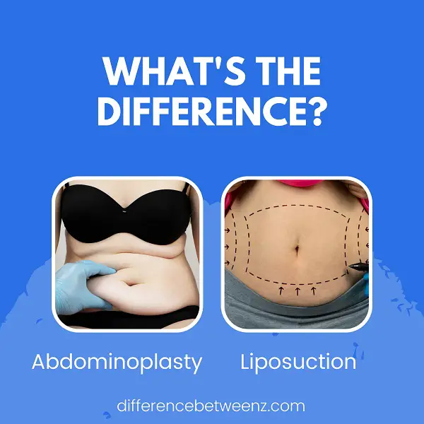 Difference between Abdominoplasty and Liposuction