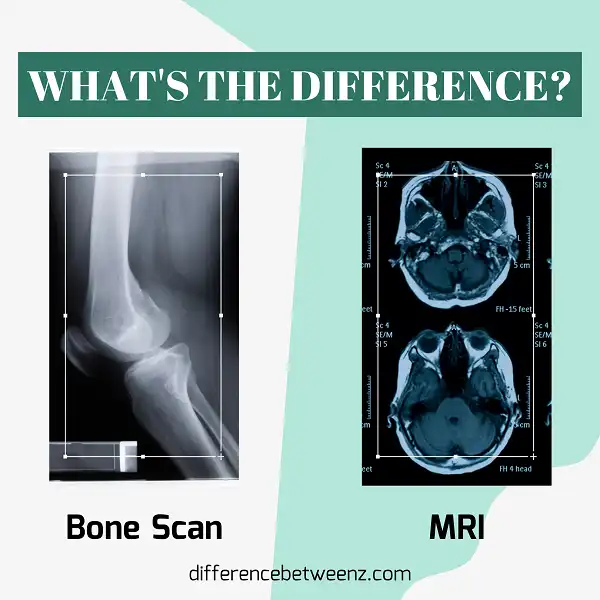 Difference between Bone Scan and MRI