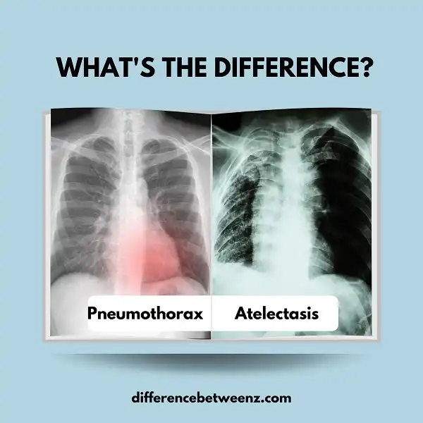 Difference between Pneumothorax and Atelectasis