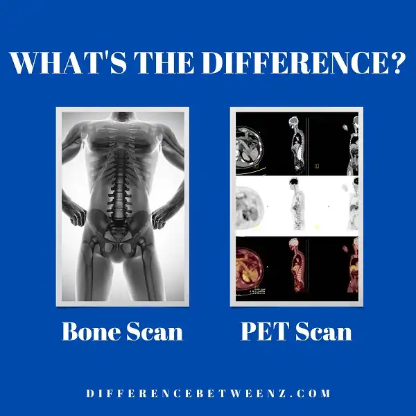 Difference between a Bone Scan and a PET Scan