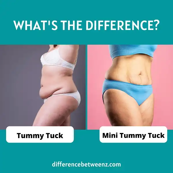 Difference between Tummy Tuck and Mini Tummy Tuck