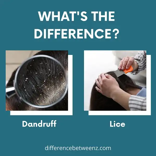 Difference between Dandruff and Lice