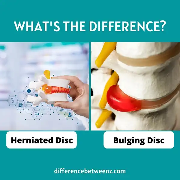 Difference between Herniated and Bulging Disc