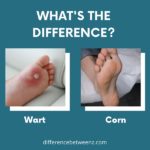 Difference between Wart and Corn
