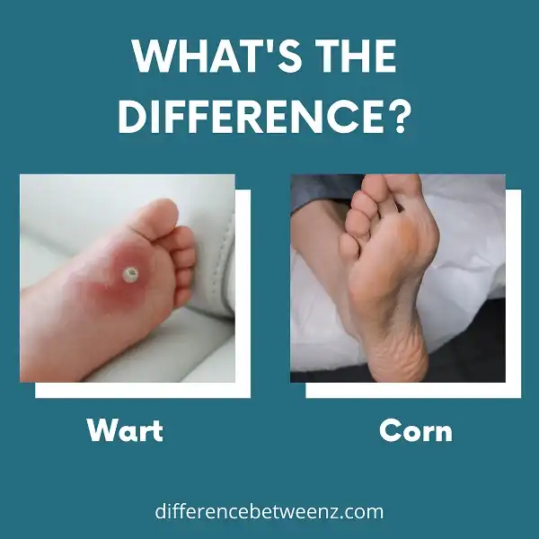 Difference between Wart and Corn