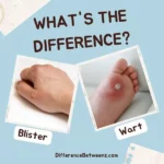 Difference between a Blister and a Wart