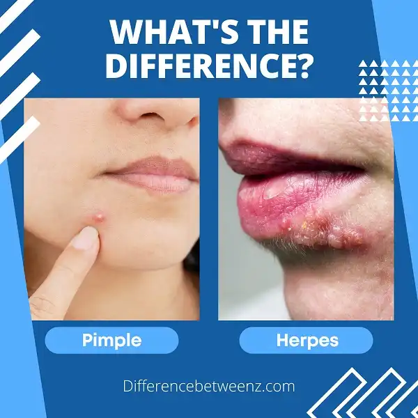 differences-between-a-pimple-and-herpes-difference-betweenz