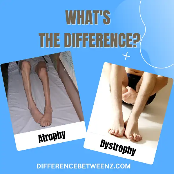 Difference between Atrophy and Dystrophy