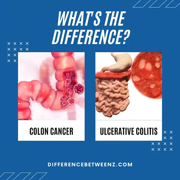 Difference between Colon Cancer and Ulcerative Colitis