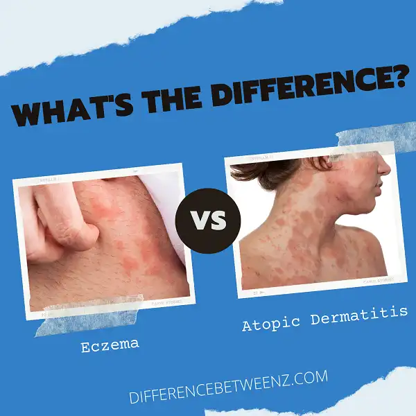 Difference between Eczema and Atopic Dermatitis