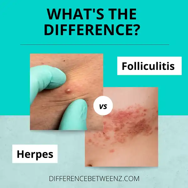 Difference between Folliculitis and Herpes