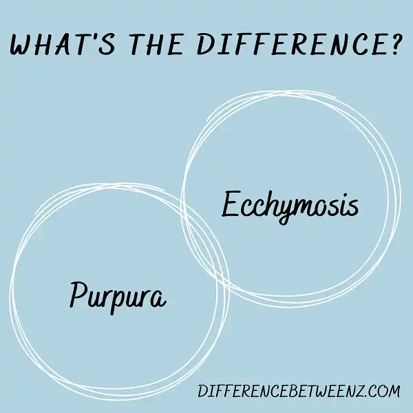 Difference between Purpura and Ecchymosis