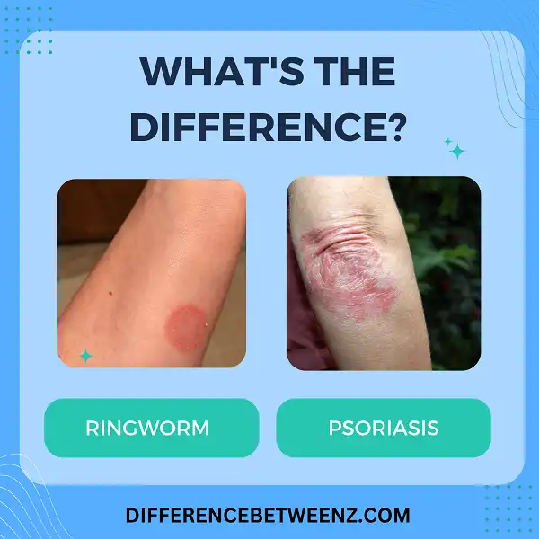 Difference between Ringworm and Psoriasis