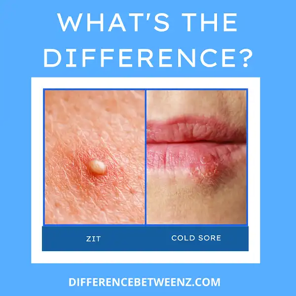 Difference between Zit and a Cold Sore