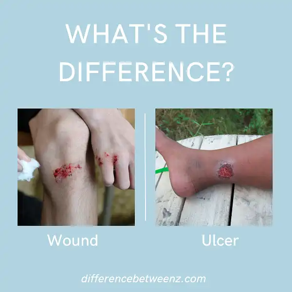 Difference between a Wound and an Ulcer