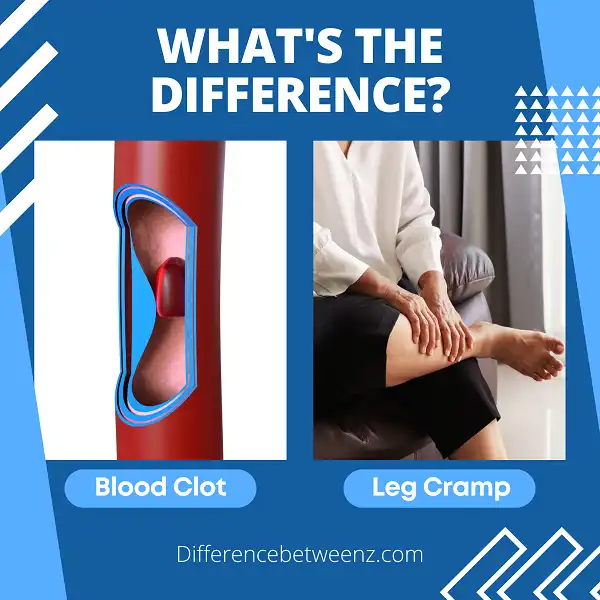 Difference between Blood Clot and Leg Cramp