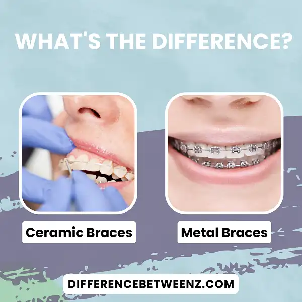 Difference between Ceramic Braces and Metal Braces