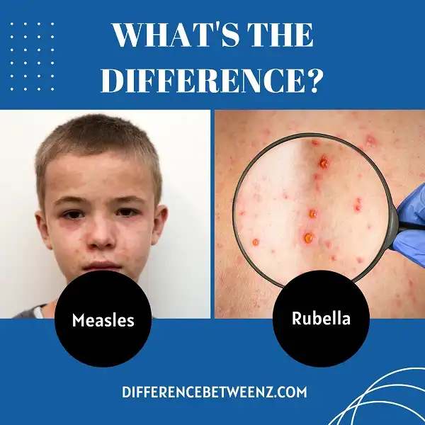 Difference between Measles and Rubella